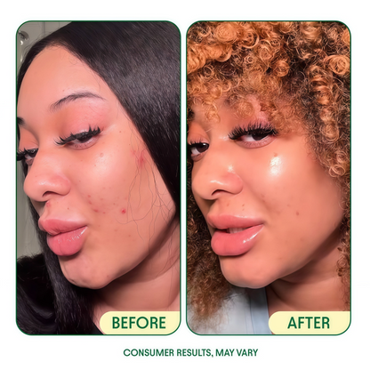 Korean Skincare Renewal & Hydration Bundle