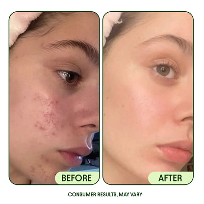 Renewal Toner Pads with Niacinamide & Peptides